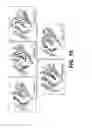 Fig. 11 - HNF4-alpha ANTAGONIST AND USE THEREOF