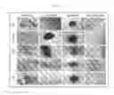 Fig. 13 - CHORION-DERIVED MSCS CELLS AND CONDITIONED MEDIA AS INDUCER FOR ANGIOGENESIS APPLICATION FOR THE TREATMENT OF CARDIAC DEGENERATION.