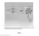 Fig. 04 - METHOD FOR TREATING ALS VIA THE INCREASED PRODUCTION OF FACTOR H