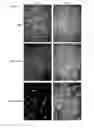Fig. 03 - STEM CELL MICROPARTICLES AND miRNA