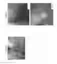 Fig. 02 - COMPOSITION COMPRISING NETTLE
