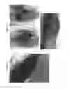 Fig. 03 - COMPOSITION COMPRISING NETTLE