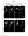 Fig. 07 - METHOD OF REGULATING NEURONAL AXON ELONGATION
