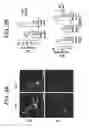 Fig. 05 - METHODS FOR TREATMENT OF MICROCEPHALY ASSOCIATED AUTISM DISORDERS