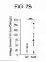 Fig. 16 - METHODS FOR TREATMENT OF MICROCEPHALY ASSOCIATED AUTISM DISORDERS
