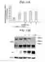 Fig. 21 - METHODS FOR TREATMENT OF MICROCEPHALY ASSOCIATED AUTISM DISORDERS