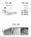 Fig. 23 - METHODS FOR TREATMENT OF MICROCEPHALY ASSOCIATED AUTISM DISORDERS