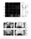 Fig. 07 - THERAPEUTIC USE OF VEGF-C AND CCBE1