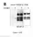 Fig. 09 - THERAPEUTIC USE OF VEGF-C AND CCBE1