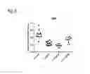 Fig. 06 - Methods of using pegylated interleukin-10 for treating hyperlipidemia