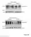 Fig. 14 - LACTOFERRIN AND MEMORY AND LEARNING SPEED IN CHILDREN