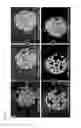 Fig. 16 - Method and compositions for inhibiting or preventing adverse effects of oral antibiotics