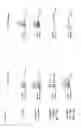 Fig. 06 - Method to generate antibodies to ion channels