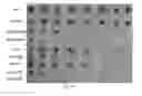 Fig. 08 - Multi-targeted Ubenimex prodrug derivative and preparation method and use thereof