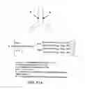Fig. 233 - FACTOR VIII: REMODELING AND GLYCOCONJUGATION OF FACTOR VIII