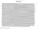 Fig. 309 - FACTOR VIII: REMODELING AND GLYCOCONJUGATION OF FACTOR VIII