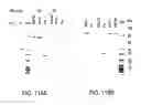 Fig. 414 - FACTOR VIII: REMODELING AND GLYCOCONJUGATION OF FACTOR VIII