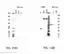 Fig. 415 - FACTOR VIII: REMODELING AND GLYCOCONJUGATION OF FACTOR VIII