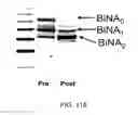 Fig. 417 - FACTOR VIII: REMODELING AND GLYCOCONJUGATION OF FACTOR VIII