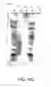 Fig. 464 - FACTOR VIII: REMODELING AND GLYCOCONJUGATION OF FACTOR VIII