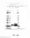 Fig. 467 - FACTOR VIII: REMODELING AND GLYCOCONJUGATION OF FACTOR VIII