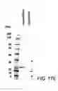 Fig. 480 - FACTOR VIII: REMODELING AND GLYCOCONJUGATION OF FACTOR VIII