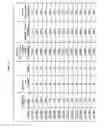 Fig. 16 - Dosages of immunoconjugates of antibodies and SN-38 for improved efficacy and decreased toxicity