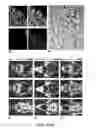 Fig. 03 - Imaging brown adipose tissue with curcumin derivatives