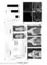 Fig. 04 - Imaging brown adipose tissue with curcumin derivatives