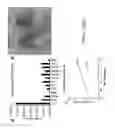 Fig. 12 - Imaging brown adipose tissue with curcumin derivatives