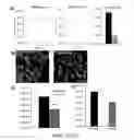 Fig. 18 - Imaging brown adipose tissue with curcumin derivatives