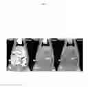 Fig. 04 - SILICONE-BASED ENTERIC CT CONTRAST MATERIAL