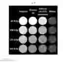 Fig. 16 - SILICONE-BASED ENTERIC CT CONTRAST MATERIAL