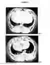 Fig. 12 - Imageable polymers