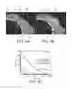Fig. 06 - Implants and biodegradable tissue markers