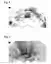 Fig. 02 - Composition and method for medical imaging of body cavities
