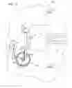 Fig. 11 - Sterilization tray