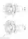 Fig. 07 - Dispensing Device with Wick Retainer