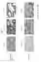 Fig. 08 - Sophisticated Implant Material
