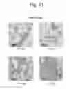 Fig. 14 - Sophisticated Implant Material