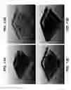 Fig. 10 - Electrochemical disinfection of implanted catheters