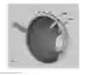 Fig. 01 - Intraocular drug delivery and filter device and methods of using same