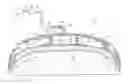 Fig. 01 - Abdominal treatment systems, delivery devices, and methods