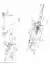 Fig. 02 - Use activated emergency alert for a medical device