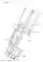 Fig. 13 - Drug delivery device