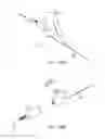 Fig. 47 - Devices and methods for tissue transfer
