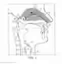 Fig. 02 - Nasal devices