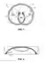 Fig. 02 - Methods for intravesical drug delivery and methods and systems for loading devices with drug tablets