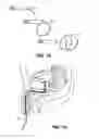 Fig. 09 - Methods for intravesical drug delivery and methods and systems for loading devices with drug tablets