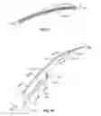Fig. 09 - Transcoronary sinus pacing system, LV summit pacing, early mitral closure pacing, and methods therefor